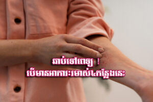 Read more about the article ឆាប់​ទៅ​ពេទ្យ ! បើ​មាន​អាកា​រៈ​រមា.ស់​៤​កន្លែង​នេះ