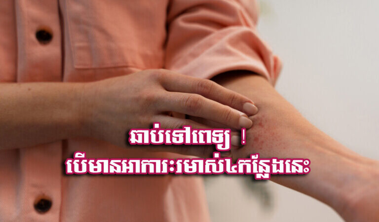 ឆាប់​ទៅ​ពេទ្យ ! បើ​មាន​អាកា​រៈ​រមា.ស់​៤​កន្លែង​នេះ